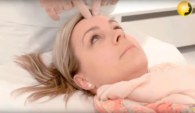 Video: Faltenbehandlung mit Botulinumtoxin