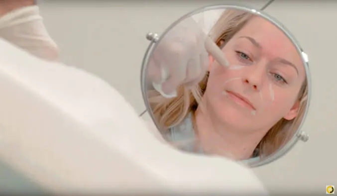 Video: Faltenbehandlung mit Hyaluron